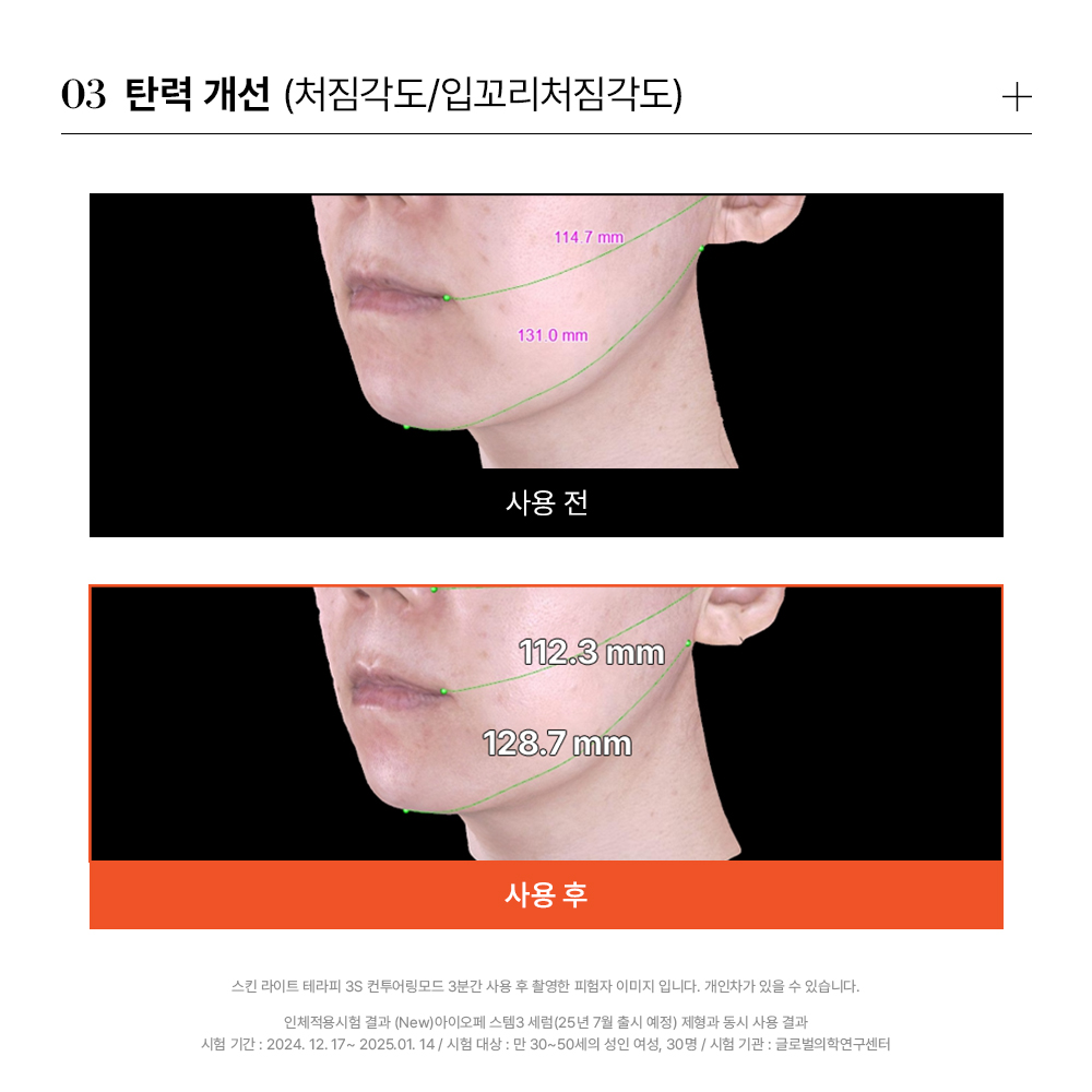스킨 라이트 테라피 3S 상품 이미지 6