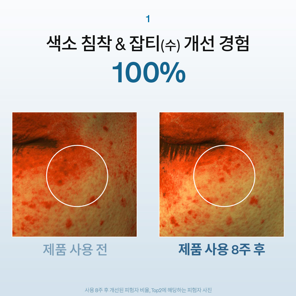 자정앰플세럼 단품기획세트 30ml 상품 이미지 5