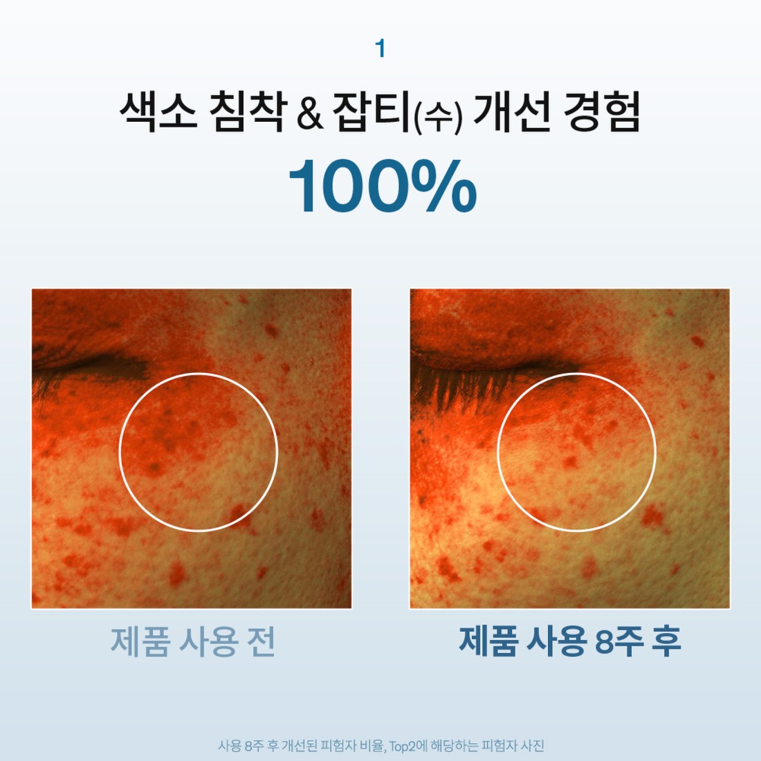 자정앰플세럼 단품기획세트 30ml 상품 이미지 5