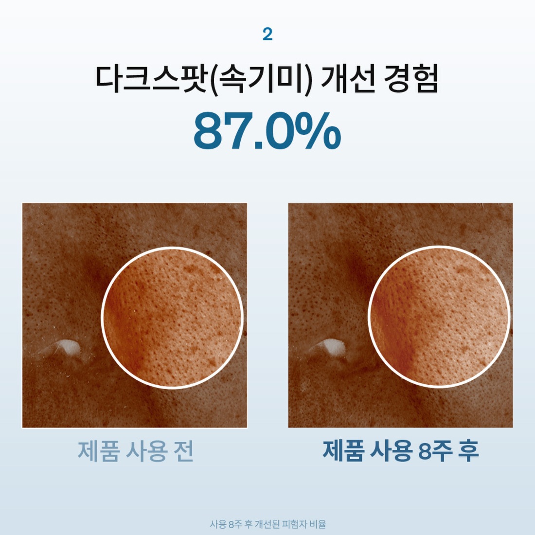 자정앰플세럼 30ml 상품 이미지 6