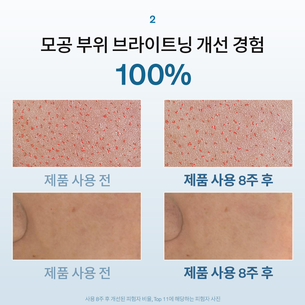 자정유액 125ml 상품 이미지 6