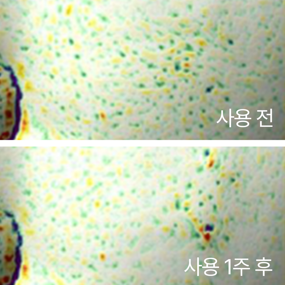 블랙티 유스 인핸싱 트리트먼트 에센스 75ml 상품 이미지 5